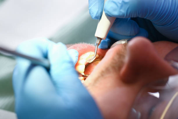 Best Dentist for Severe Toothache  in Anna, IL