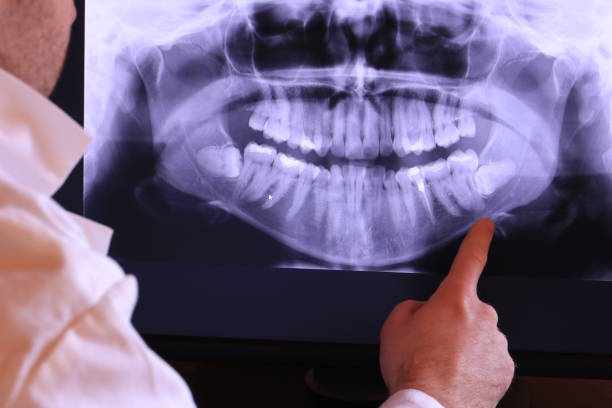 Best Tooth Infection Emergency Dentist  in Anna, IL